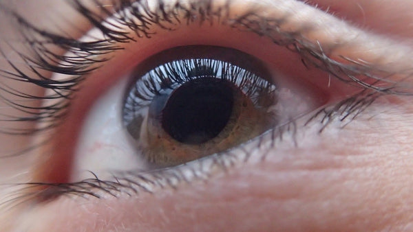 Si possono usare le lenti a contatto dopo un trapianto di cornea?